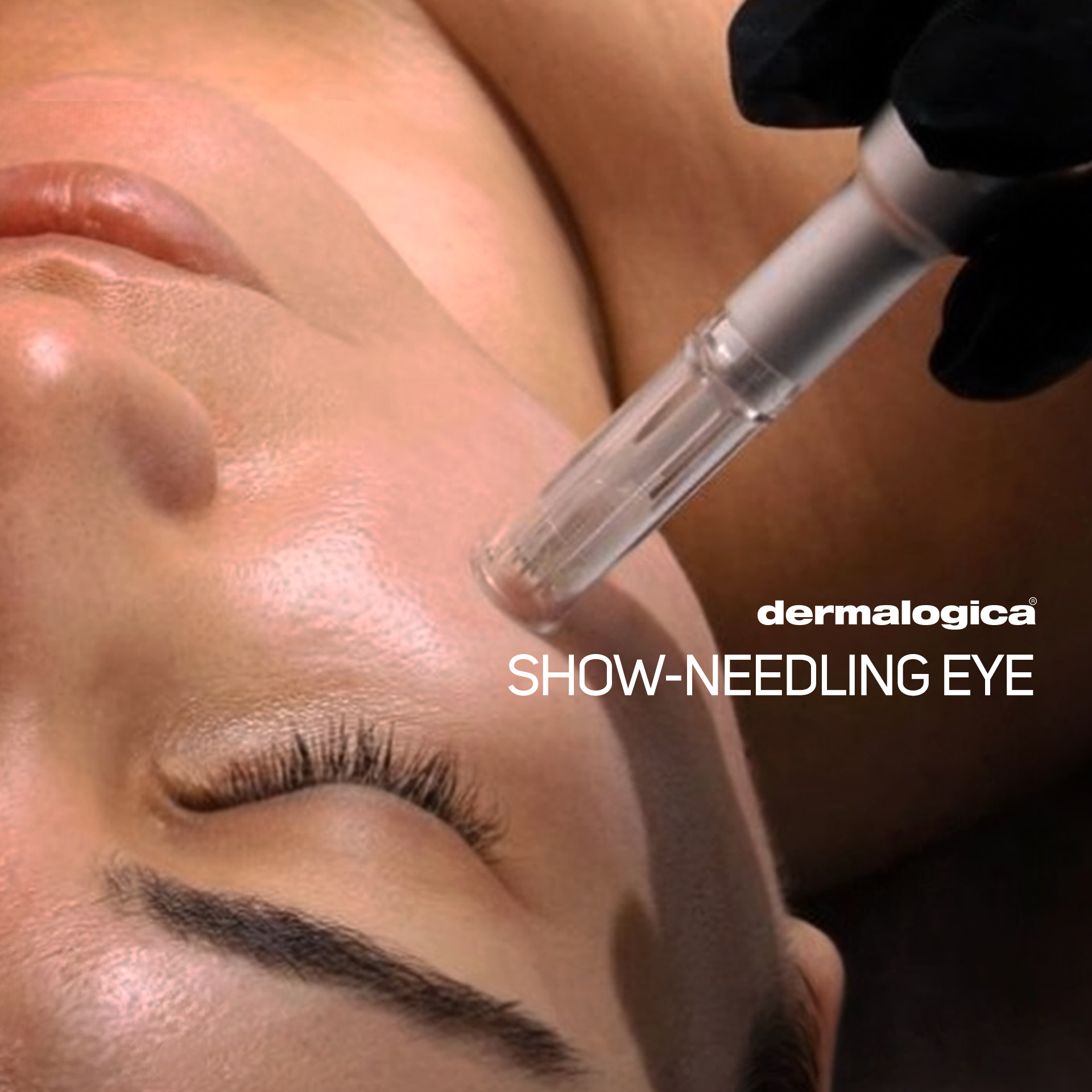 DERMALOGICA | Show-Needling Eye